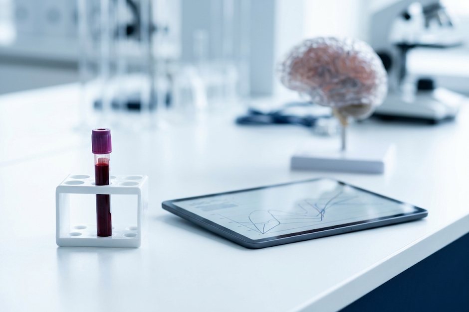 Blutprobe im Laborständer neben Tablet mit Messdaten, im Hintergrund ein Gehirnmodell